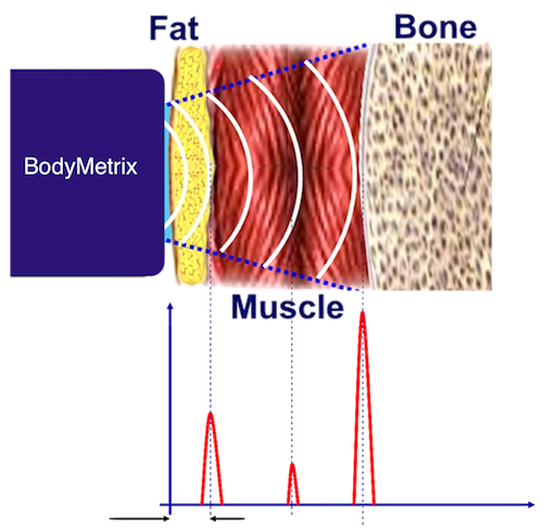 Ultrasound Basics